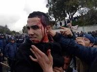 Alger : Répression féroce des étudiants devant le ministère de l'Enseignement Supérieur