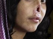 World Press Photo Award pour portrait l'Afghane défigurée