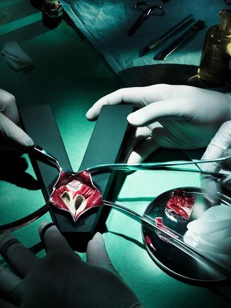 Opération à typographie ouverte. Et si la typo était un élément organique ?