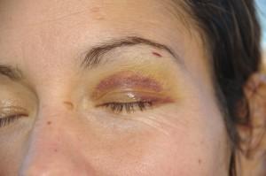 Assurances des clubs.