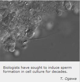 INFERTILITÉ : Des chercheurs cultivent des spermatozoïdes in vitro  – Nature