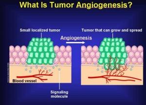 CANCER et maladies ophtalmiques: Une nouvelle biothérapie qui bloque l’angiogenèse – Journal of Experimental Medicine