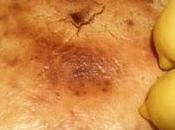 Tarte Citrons Pique N'Oeil