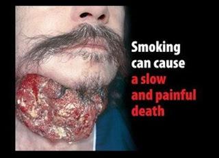 Fumer tue et fumer choque.