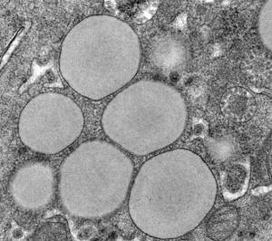 HÉPATITE C: 2 entrées virales à fermer pour le virus – Inserm- Nature Medicine