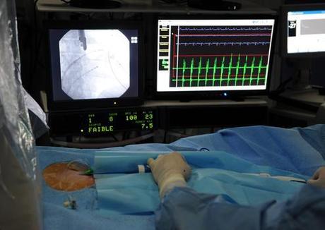 En France, la fibrillation auriculaire entraîne 30.000 accidents vasculaires cérébraux mortels