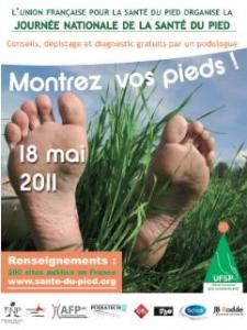JOURNÉE nationale du PIED: 18 mai, dépistage gratuit des maladies du pied – Union Française pour la Santé du Pied