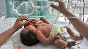 Chine : Naissance d’un bébé à deux têtes‎