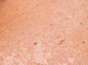 Cancer peau progression…