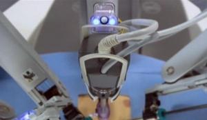 HYSTÉRECTOMIE par robot chirurgical, première mondiale à Lille – CHU Réseau