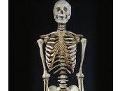 (vrai) squelette dans placard