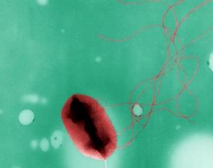 La NOUVELLE BACTÉRIE E.coli fait plus de 400 cas de dysenterie-like en Allemagne – Nature.com