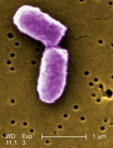 E. coli O104:H4: Un traitement, l’anticorps monoclonal eculizumab, sauve 3 patients – AAAS-New England Journal of Medicine