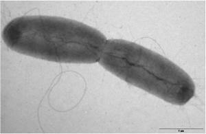E. coli: Aucun des 4 échantillons de concombre n’a permis d’identifier O104: H4  – BfR