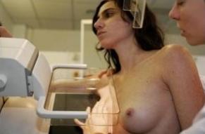 CANCER du SEIN: L’obésité diminue les chances de survie – Endocrine Society – ENDO 2011: 93rd Annual Meeting