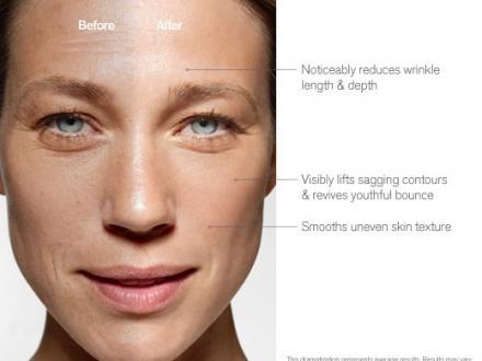 Caroline Louise Forsling