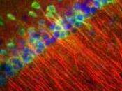 ALZHEIMER: Quelques cellules souches olfactives pour retrouver MÉMOIRE CNRS- Journal Clinical Investigation
