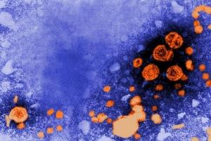 HÉPATITE C et drogues injectables: En France, le virus atteint 3 usagers sur 4  – The Lancet