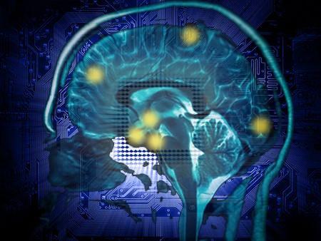 implants, chirurgie, traitement, chimie