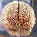 cerveau humain atteint limites