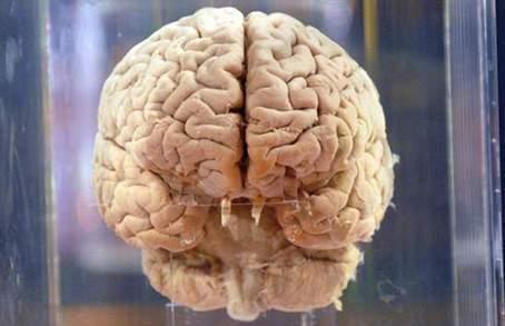 cerveau.jpg