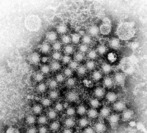 HÉPATITE C: L’espoir d’un vaccin “Virus-Like Particle” – Science Translational Medicine