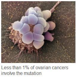CANCER de l’OVAIRE: Une mutation génétique rare multiplie le risque par 6  – Nature Genetics