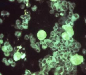 CMV et HTA: Un virus très courant facteur d’hypertension ? – Circulation