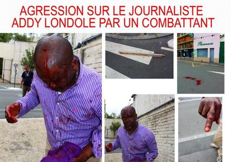 Breaking news: Le journaliste Addy Londole bléssé par le combattant Babin