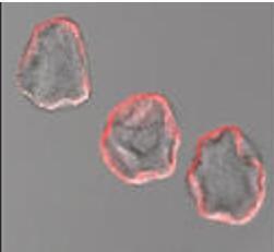 INSUFFISANCE CARDIAQUE: Développer de nouveaux vaisseaux pour améliorer la circulation  – Circulation