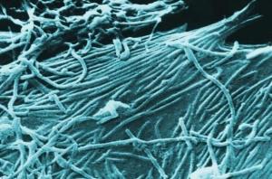 EBOLA: Des scientifiques identifient le point d’entrée du virus  – Nature