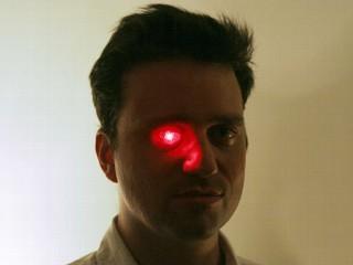 Rob Spence is the EYEBORG