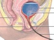 BOTOX: Autorisé l’Afssaps pour l’incontinence cause neurologique