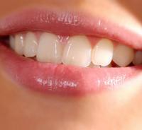 Décodage dentaire : noms symboliques des dents
