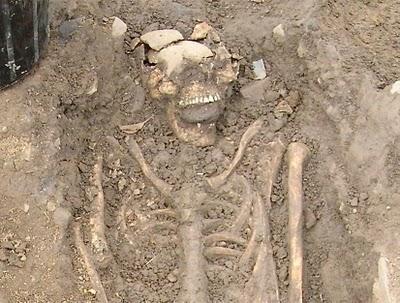 Irlande: deux squelettes du 8ème siècle découverts avec une pierre dans la bouche