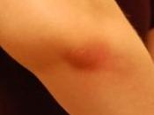 pression supplémentaire