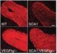 ATAXIE: La protéine VGEF peut ralentir la maladie – Nature Medicine