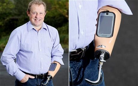 Inédit: Un iPhone dans une prothèse humaine