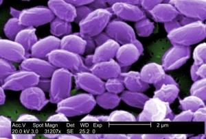 U.S. et bioterrorisme: Vaccin contre l’ANTHRAX, faut-il le tester sur l’Enfant ? – Science Insider