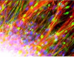 DIABÈTE: Le grand espoir des cellules souches  – EMBO Molecular Medicine