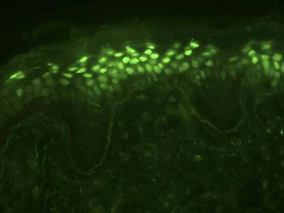 CELLULES DE JOUVENCE ?