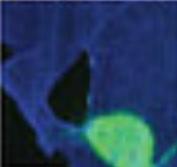 PARKINSON: Des neurones tout neufs à partir de cellules souches – Nature