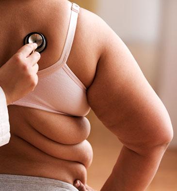 Gène de gain de poids excessif et l'obésité