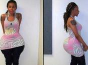 Arrêtée pour avoir injecté ciment dans fesses d'une femme