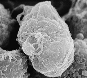 VACCIN anti VIH: Espoir avec un anticorps qui se lie par un sucre au virus – Nature et Science