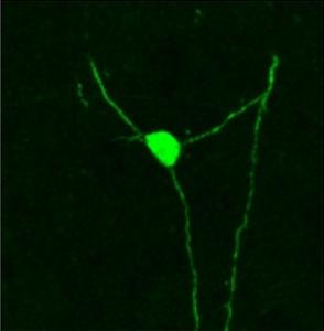 CERVEAU: Avec des neurones neufs, des chercheurs réparent des circuits cérébraux – Science