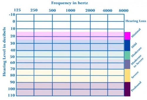 audiogramme, perte auditive, audition