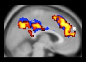 PSYCHO: La neuroscience pour expliquer la morale et le Code pénal – Social Cognitive and Affective Neuroscience