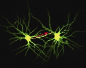 MÉMOIRE et vieillissement: La protéine qui pourrait rajeunir nos neurones – The Journal of Neuroscience