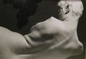 ALISON LAPPER, une leçon de vie !